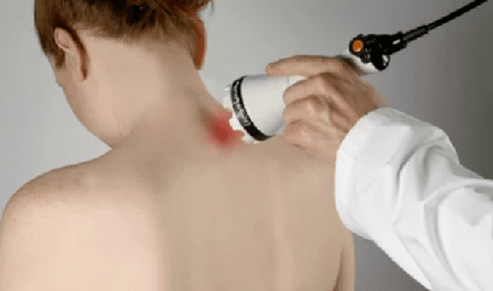 Treatment of cervical joint disease by physiotherapy