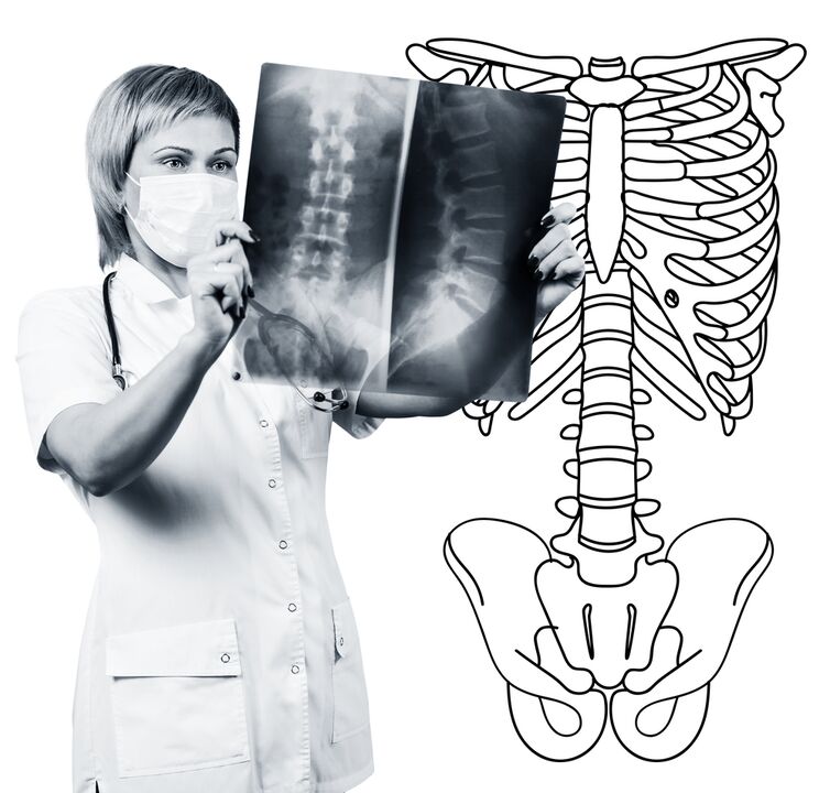 X -ray of the lumbar spine