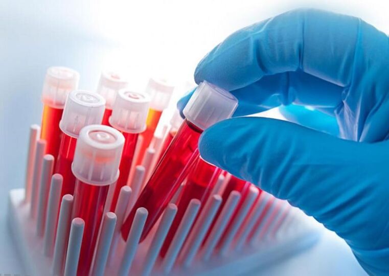 blood test to look for bone necrosis