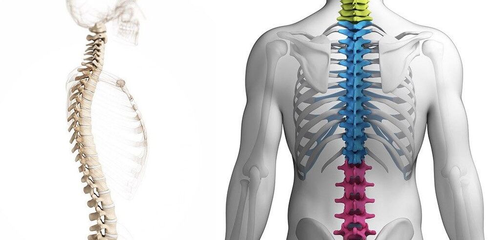 thoracic spine injury with osteonecrosis