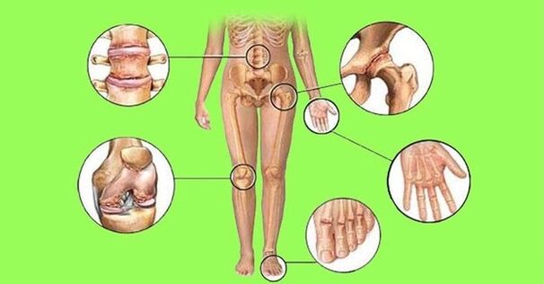 joints affected by arthritis and rheumatism