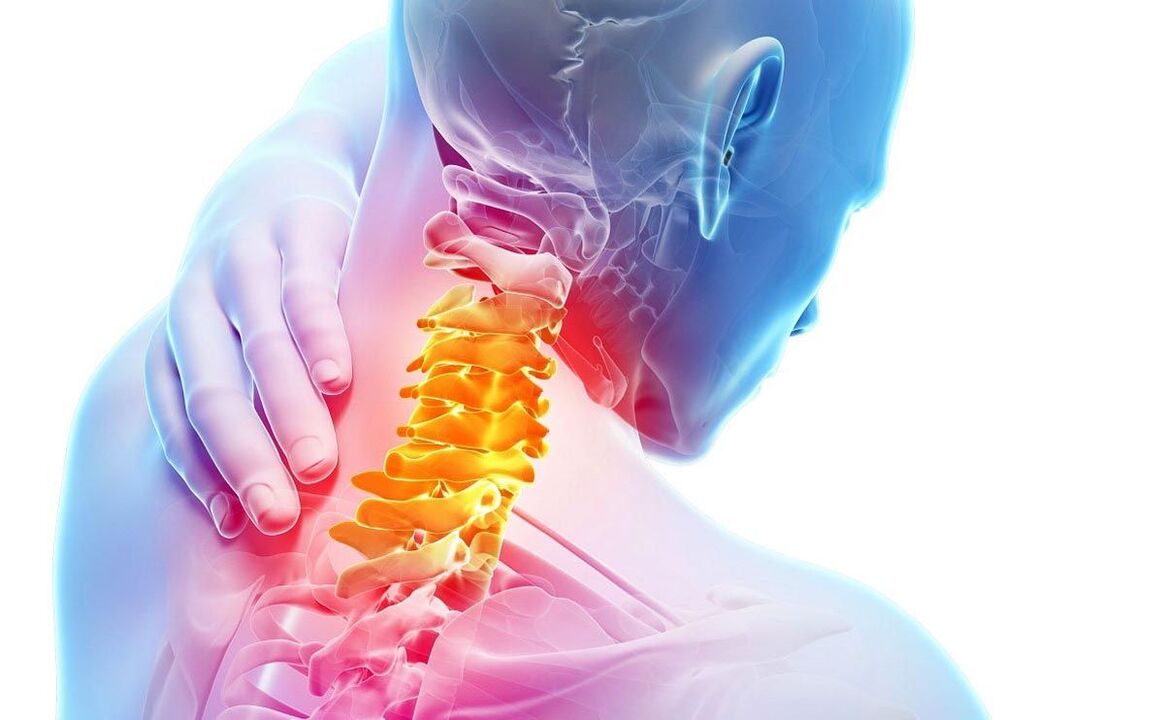 pain due to cervical spondylosis