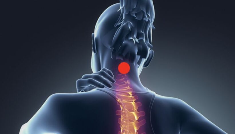 symptoms of cervical spondylosis