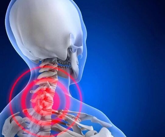 Cervical bone